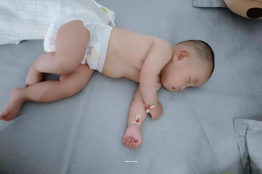 贵港六个月宝宝眼睛散光